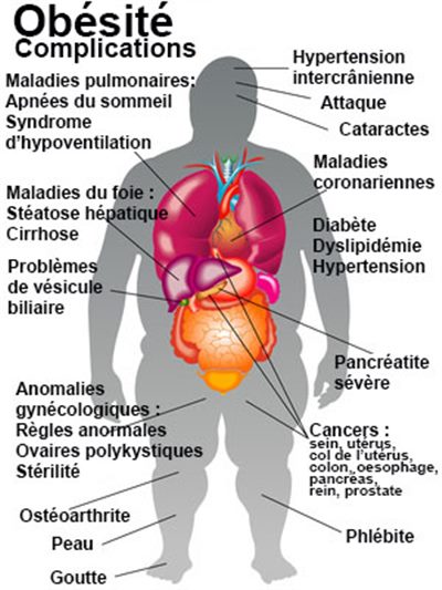 Slectionnature4's tweet photo. #PlusDe70kgEtSereine

Toutes les femmes de plus de 70kg ne sont pas en surpoids, ça dépend de l'IMC. Je trouve cependant dangereux le fait de normaliser l'obésité, qui est une maladie mortelle.
Prenez soin de vous. https://t.co/rPYsimcDGt
