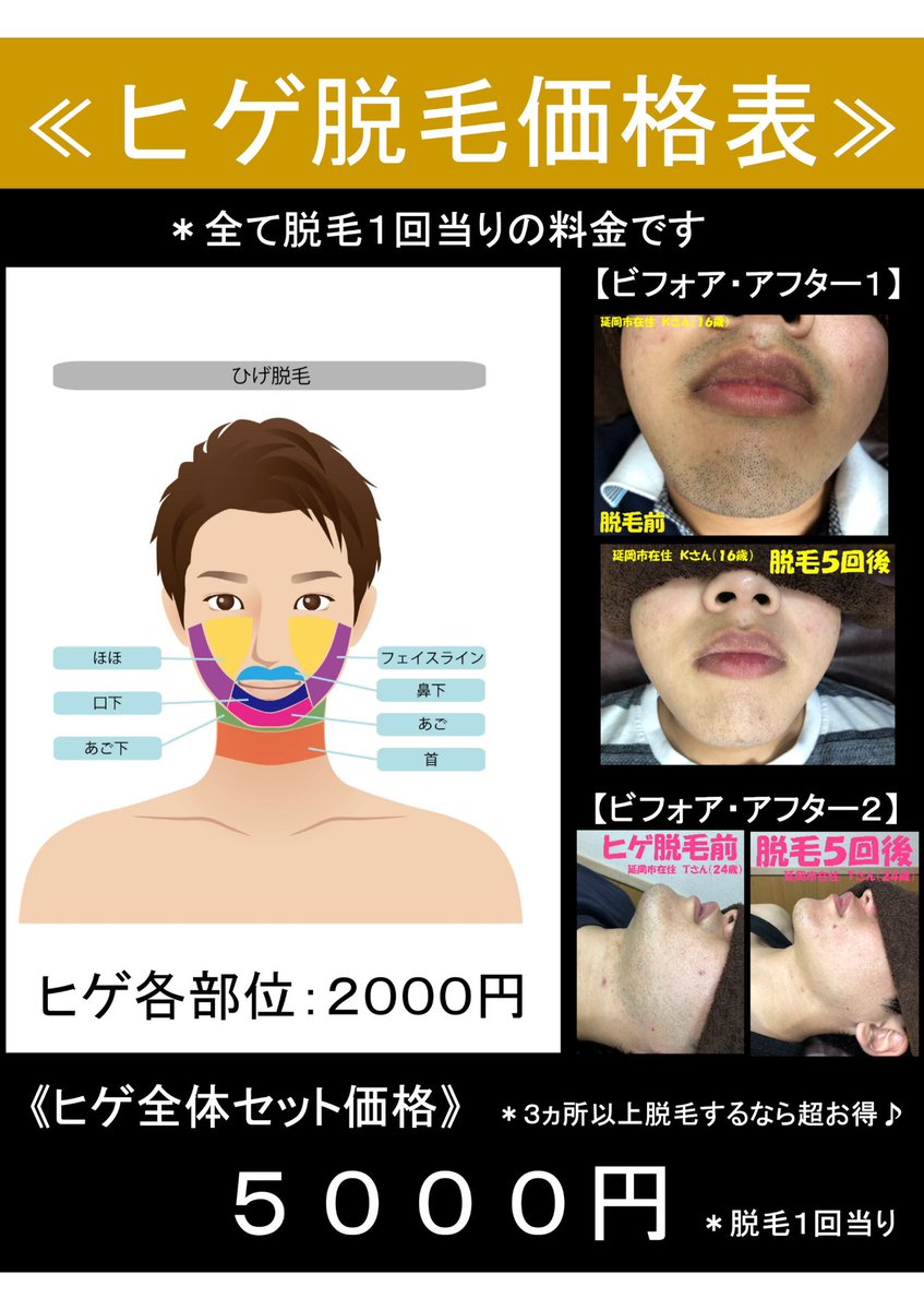 男性専用脱毛サロン 艶男 Tsuyadan Tsuyadan Twitter 男性専用脱毛サロン 艶男 Tsuyadan Tsuyadan Twitter