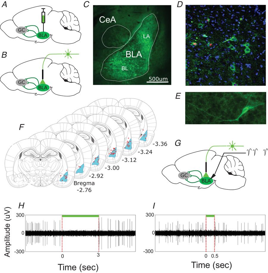 JPhysiol's tweet photo. Could the #basolateralamygdala → #nucleusbasalismagnocellularis pathway be involved in the formation of #taste? How does neuronal dynamics across multiple brain regions support long‐term #memory formation? New research from @anan_moran @TelAvivUni 👉  https://t.co/cUi222N9wq https://t.co/rbjMIo5dyS