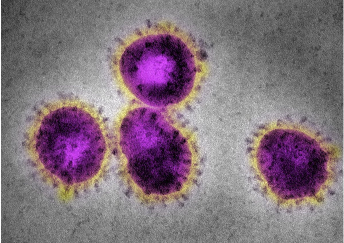  #SARSCoV2 has been photographed many times with electron microscopy. As all coronaviruses it is spiky, hence its name (corona in latin = crown).e.g.  https://www.nature.com/articles/d41586-020-00154-w?sf229468909=1