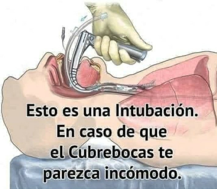 leo_flowers100's tweet photo. Entiende! https://t.co/OLjC62QZnH