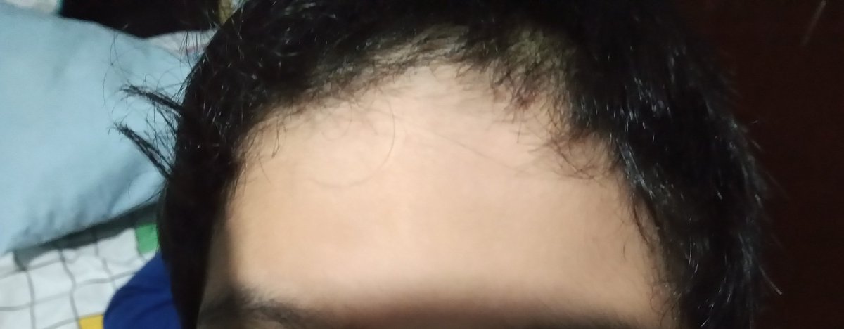 lafoudeschats's tweet photo. Pues que me meto a bañar y mientras tanto, la cría se puso a "jugar a la peluquería" y aquí el resultado 😅😭🙊
#humancub https://t.co/uyo7b4Q1sJ