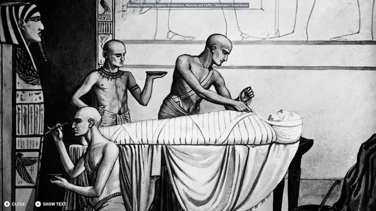 OSG_TRXMONEY's tweet image. Who needs hair????