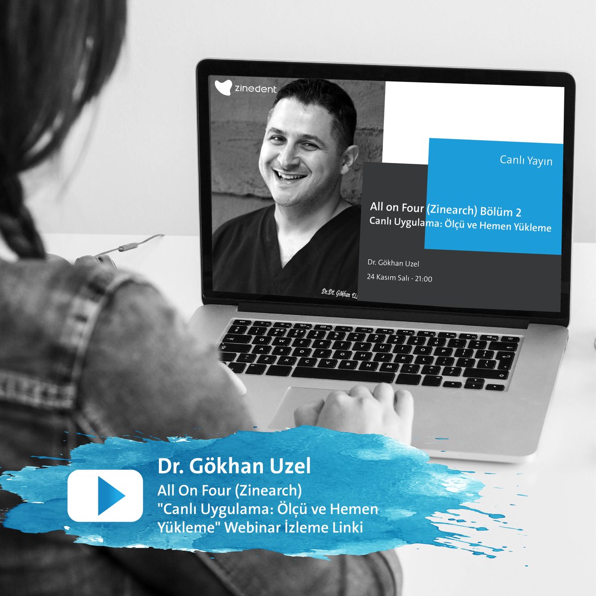 NeodentImplant's tweet photo. ● 24 Kasım'da değerli hocamız Dr. Gökhan Uzel ile birlikte gerçekleştirdiğimiz, büyük ilgi gören All On Four (Zinearch) "Canlı Uygulama: Ölçü ve Hemen Yükleme" Webinarını izlemek için tıklayın > https://t.co/oOKyYtKudc

#zinedent #straumanngroup #allonfour #zinearch #implant https://t.co/D7W0m73BCM