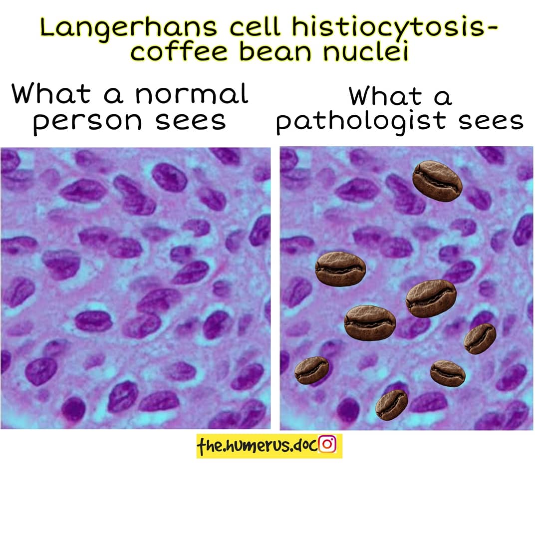 Thread on what a normal person sees vs what a pathologist sees