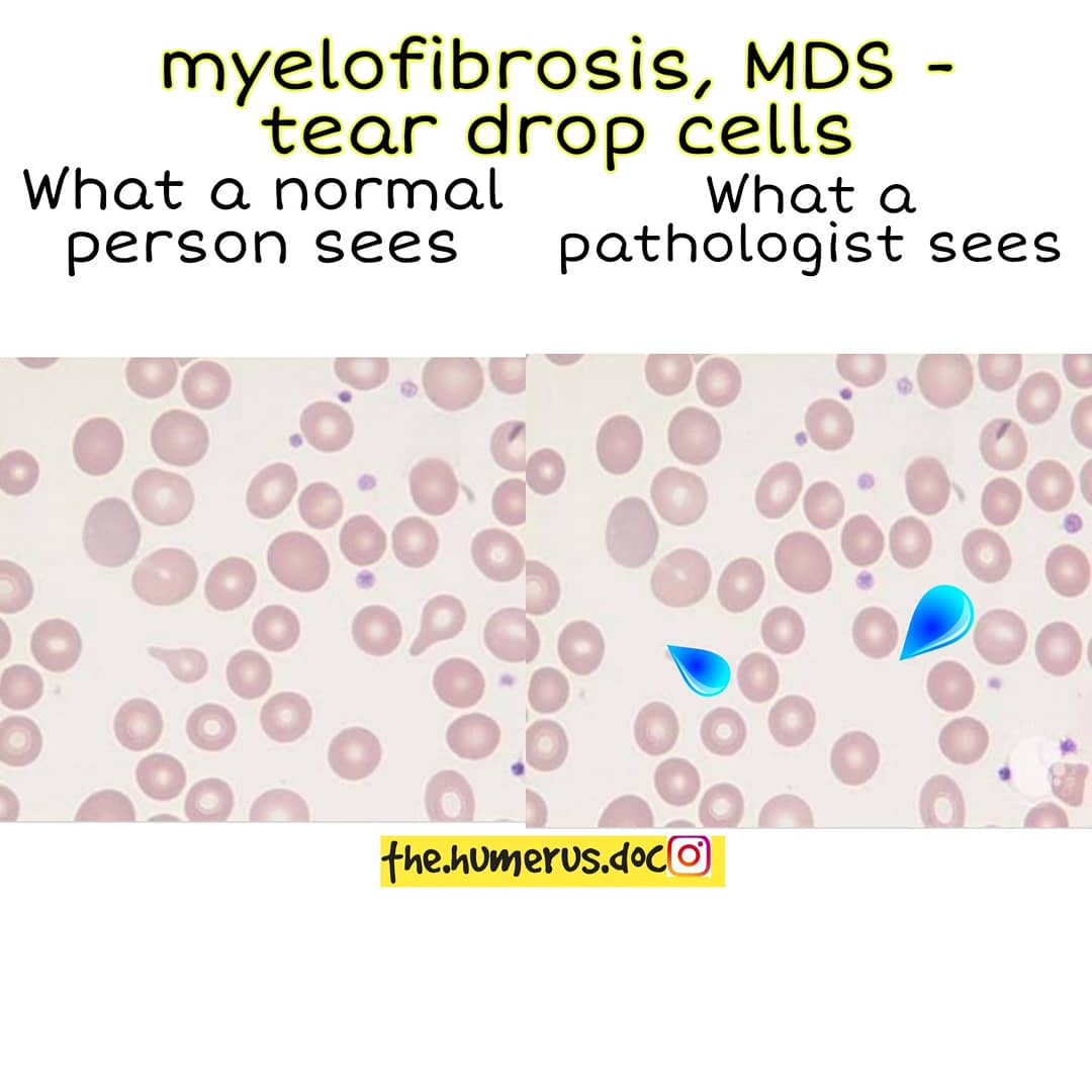 Thread on what a normal person sees vs what a pathologist sees