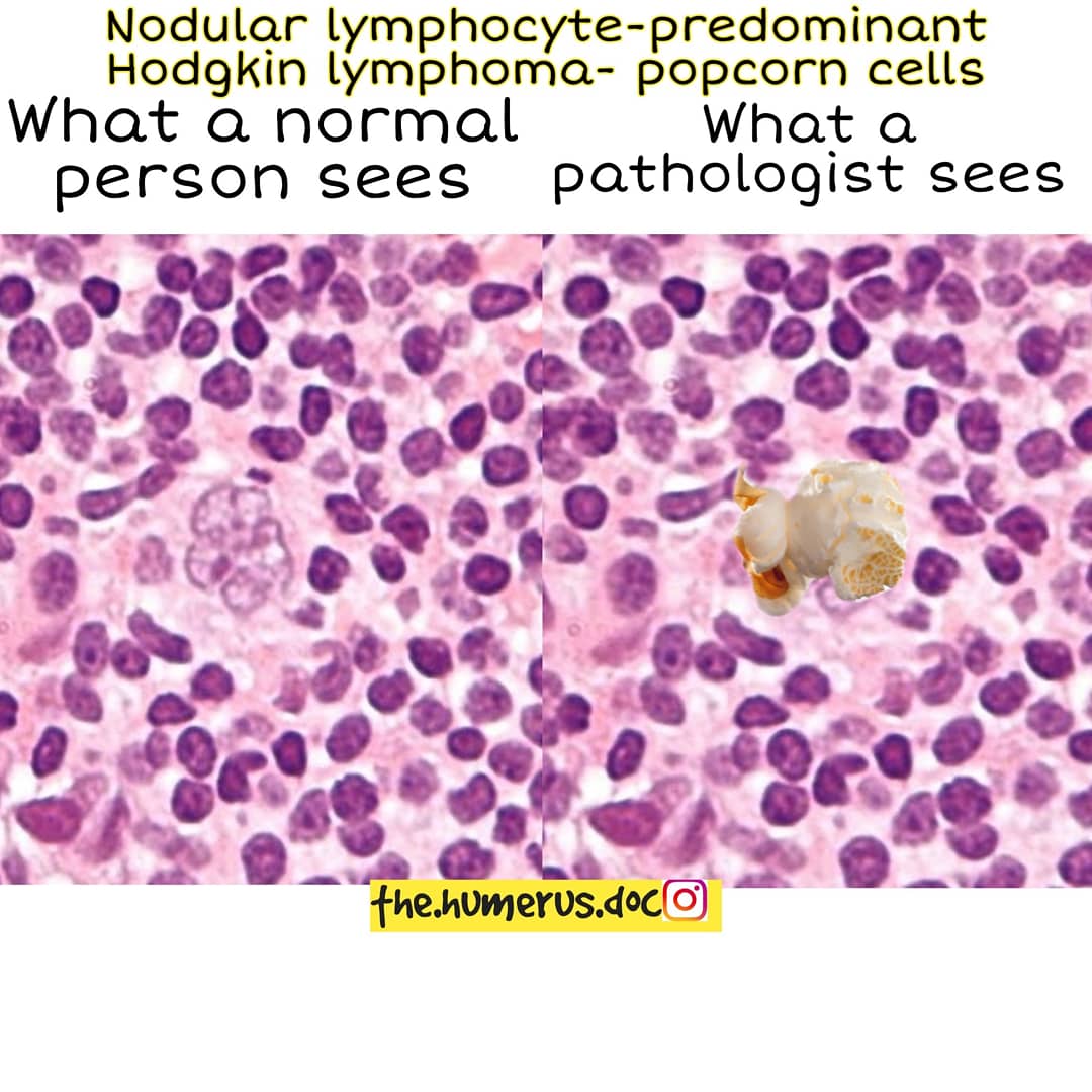 Thread on what a normal person sees vs what a pathologist sees