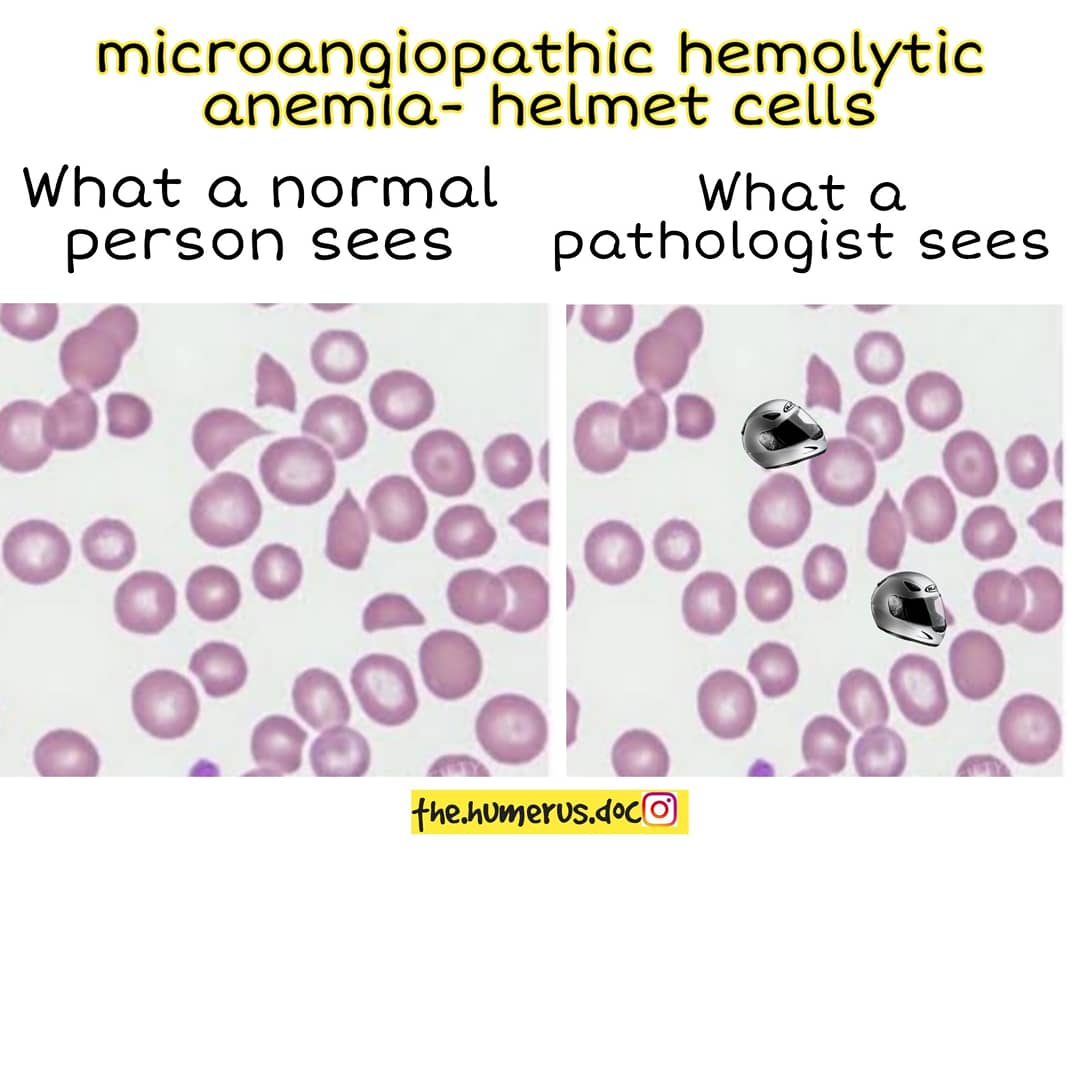 Thread on what a normal person sees vs what a pathologist sees