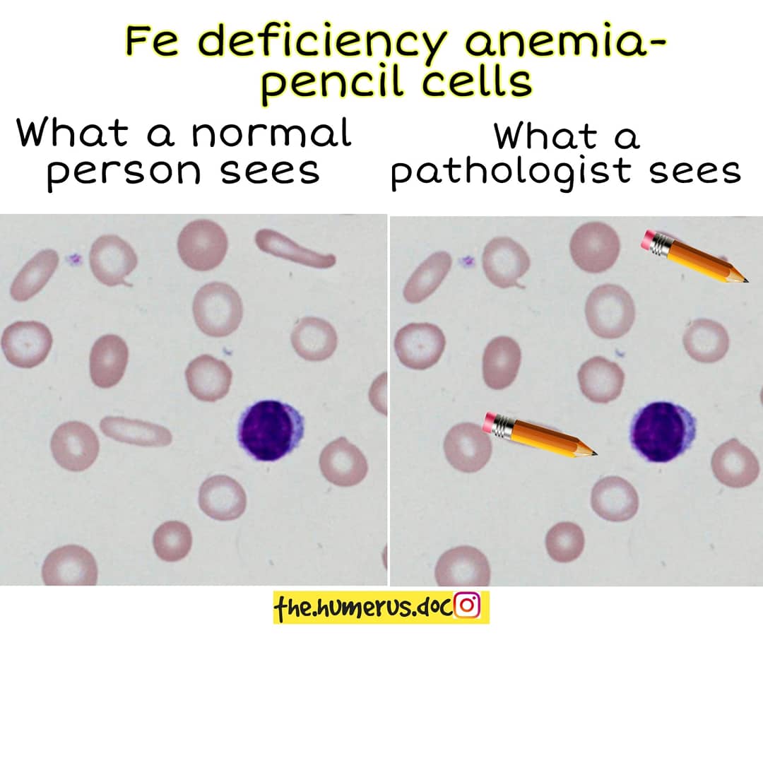 Thread on what a normal person sees vs what a pathologist sees