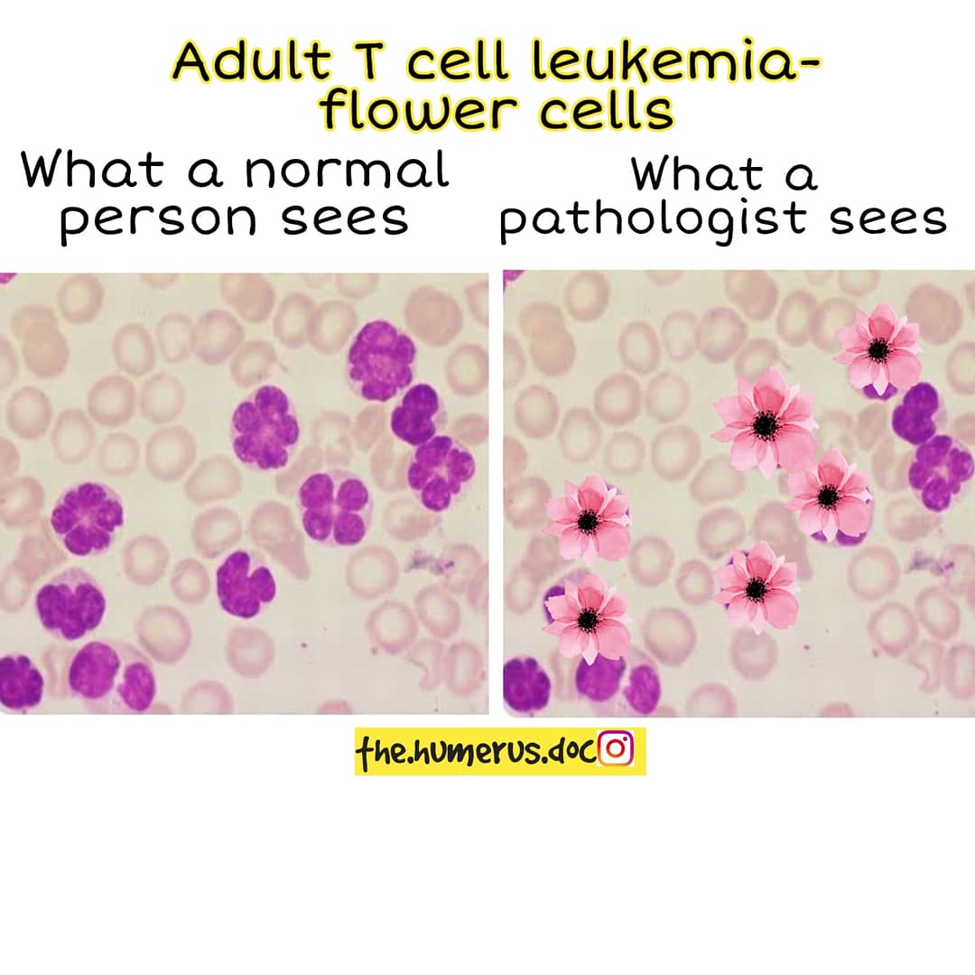 Thread on what a normal person sees vs what a pathologist sees