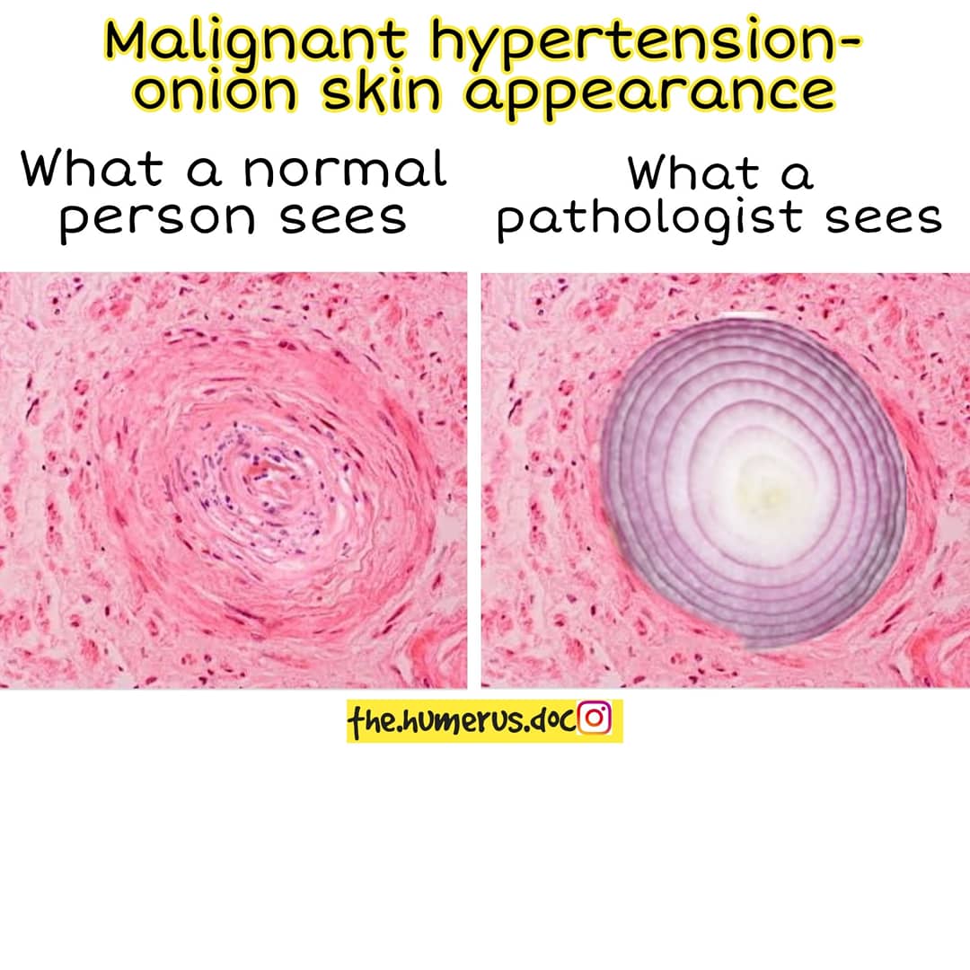 Thread on what a normal person sees vs what a pathologist sees