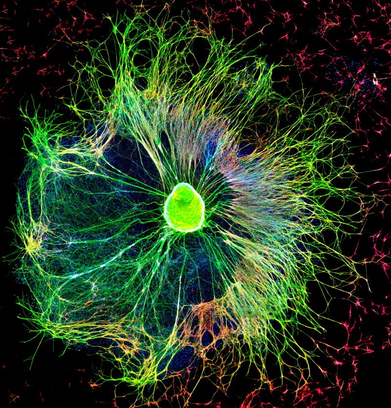 Co_Biologists's tweet photo. It wouldn't be Christmas without a Christmas star and on day 15 of #BiologistsAdvent, @J_Cell_Sci delivers a festive alternative 🎄⭐

Today, enjoy this explosive image of a sensory neuron explant growing over repair Schwann cells in vitro from work by @felipecourtg and his team. https://t.co/CF8iQ7Dxgw