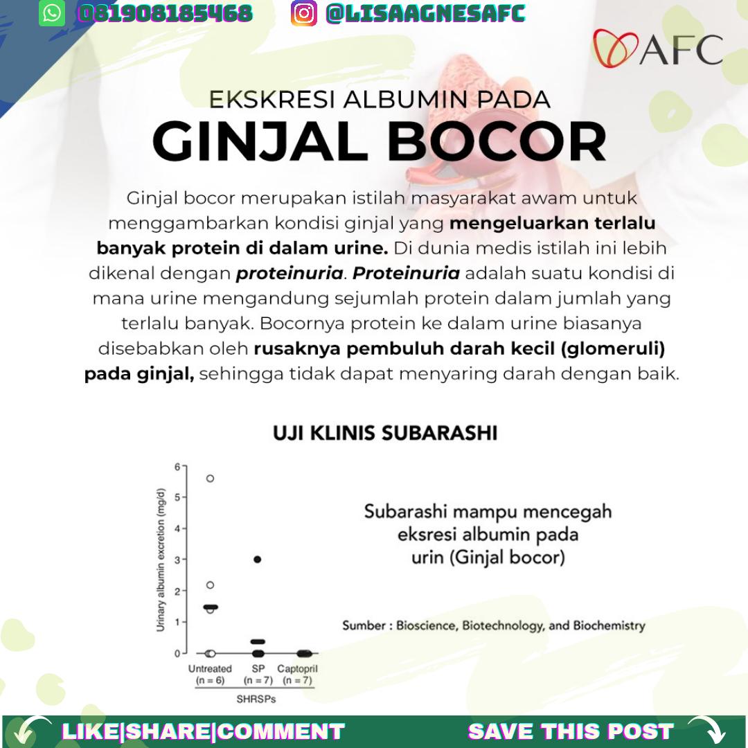 Berdasarkan Uji Klinis, SOP Subarashi mampu Mencegah Ekskresi Albumin pada Ginjal Bocor lho

More info/konsultasi
WA: wa.me/6281908185468
IG: @LisaAgnesAFC
Website: timsemut.com/l1s44p
Lisa💎

#lisaagnesafc #afclifescience #afcjepang #afcjapan #ginjalbocor #subarashi