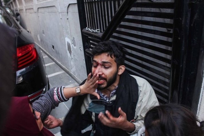 SimraAnsari_'s tweet photo. It's been an year, an year when the state terrorised, students suffered and the world watched.

#15DecJamiaAttack
#1YearofFascistAttackAMU_JMI

@SharjeelUsmani @AyshaRenna 
@AfreenFatima136 https://t.co/O9Qr3wDgbD