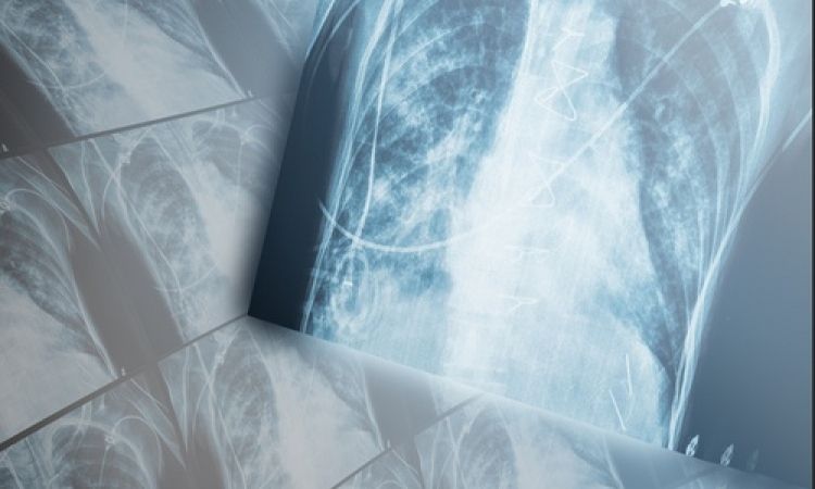 An interesting study from IHP @waferffo demonstrates that their neuromorphic chips can be used to apply artificial intelligence methods to data analysis for medical diagnostic purposes but especially, early detection of lung diseases. buff.ly/3nnQbLL