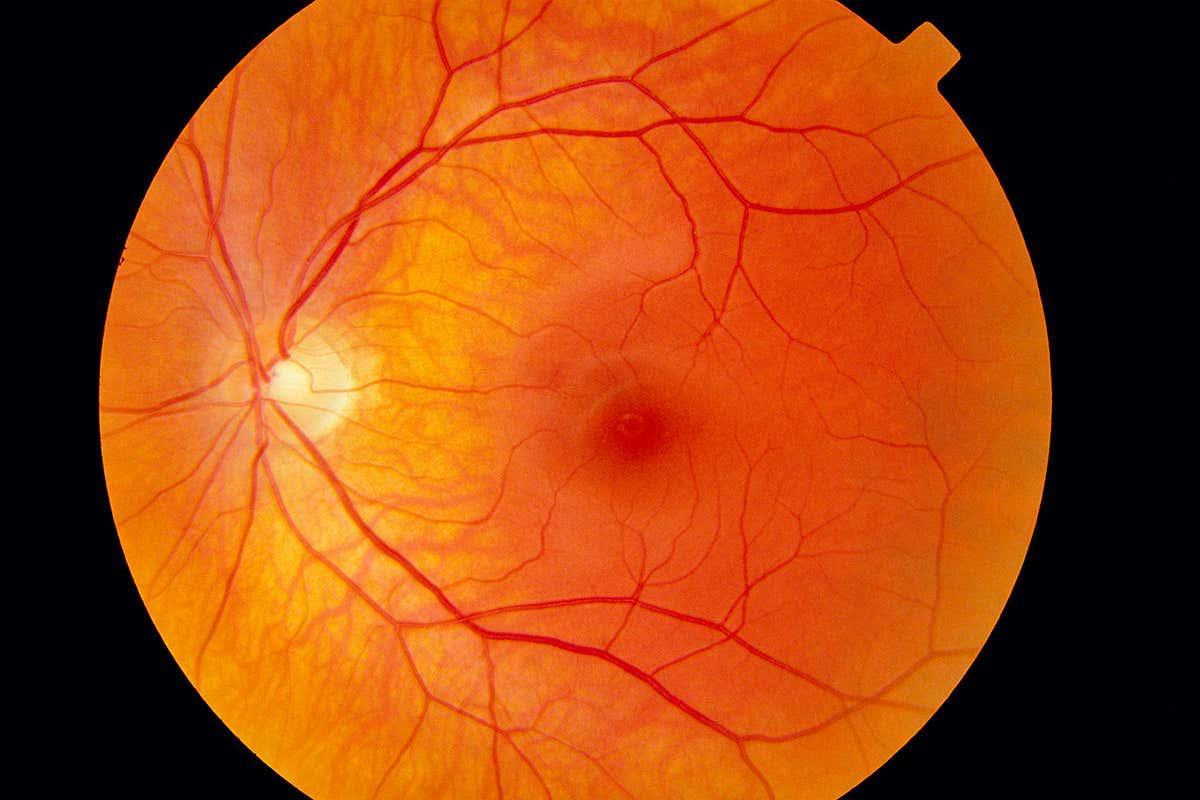 newscientist's tweet image. Gene therapy injected in one eye can travel to the other eye bit.ly/3noEkgG