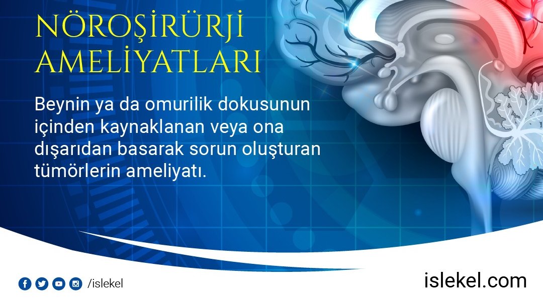 islekelsertac's tweet photo. 👉 https://t.co/nt4FDWbYry
📍 Mansuroğlu Mahallesi 286/10 Sokak Brand Office No:7 Kat:4 Daire:10 Bayraklı İzmir
☎ +90 232 422 12 00

🔖 #beyinvesinircerrahisi #beyin #nöroşirürji #nöroşirürjiameliyatı #beyinvenerji #enerji #düşünce #nöronlar #gammaknife #gammaknifenedir https://t.co/9VffZXCBye