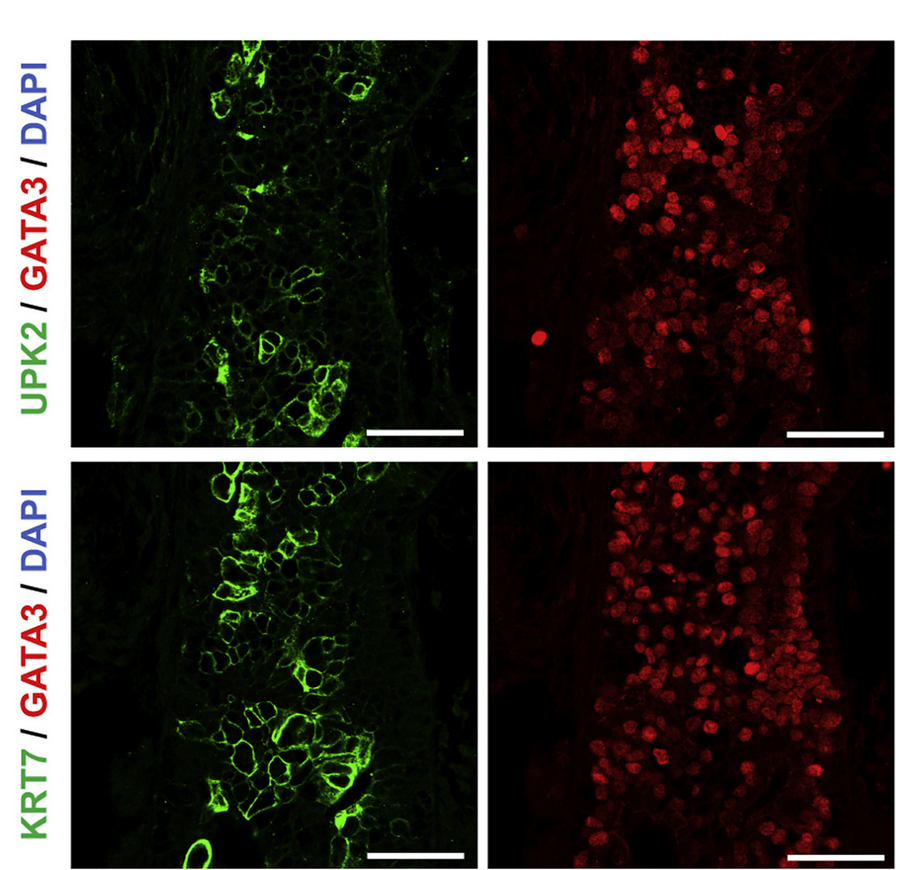 3/ We also found urothelial cells (though no lumen) suggesting the possibility of developing protocols that generate a collecting system and ureter  @MysorekarLab