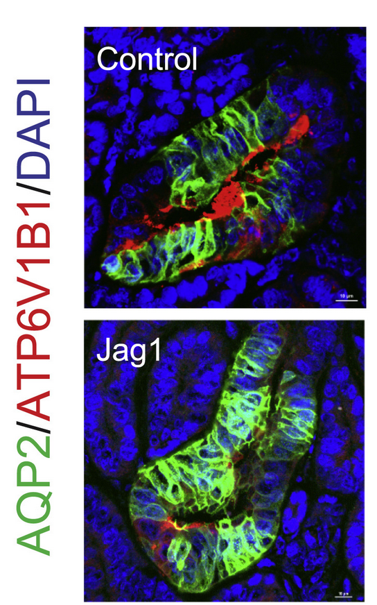 6/ And manipulating Notch signaling alters the ratio of principal cells to intercalated cells – recalling beautiful mouse data showing same from  @KSusztak
