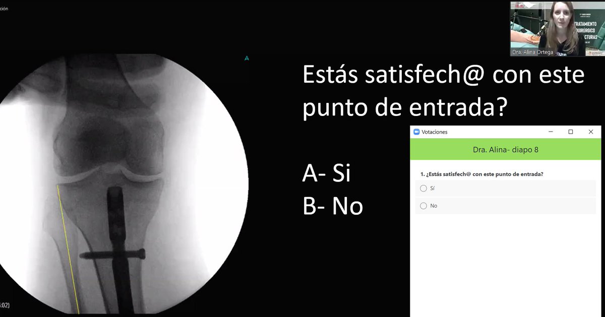 cot_csi's tweet photo. Para acabar el módulo de hoy, la Dra. Alina Ortega, desde Liverpool University Hospitals, nos responde a la pregunta "¿En el manejo de las fracturas diafisarias de tibia, pueden coexistir las placas y los clavos? Accesos quirúrgicos de los clavos" #FracturaTibia #orthotwitter https://t.co/AqxD7nx7KI