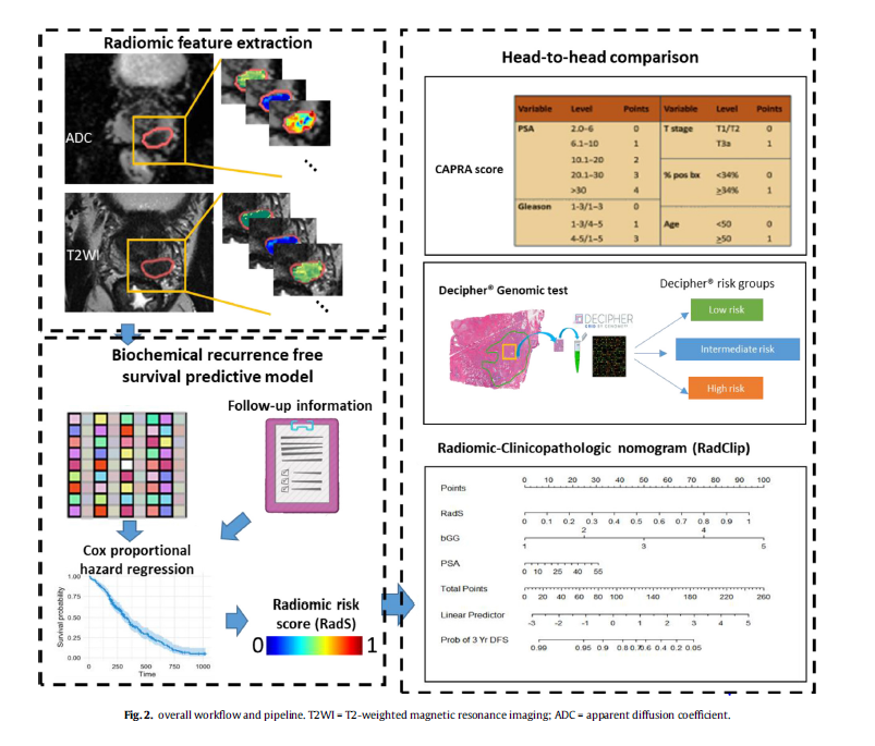 radiolobt's tweet photo. A novel imaging based Nomogram for predicting post-surgical BCR and adverse pathology of #prostatecancer from pre-operative bi-parametric MRI https://t.co/fxSDVsalhx
"All key future parts are in this paper #bpMRI #radiomics #prognosis #BCR congrats to @anantm and team" https://t.co/EANODAsWD9