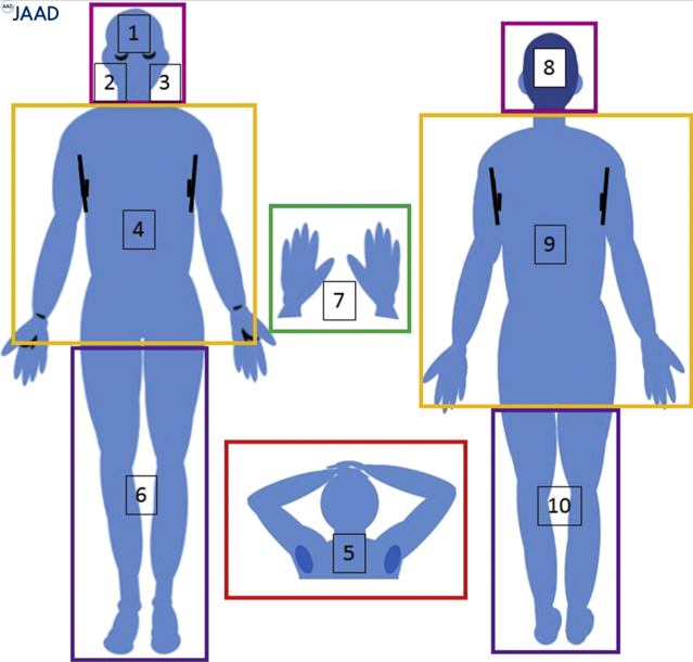 JAADjournals's tweet photo. Standardizing serial photography for assessing and monitoring vitiligo: A core set of international recommendations for essential clinical and technical specifications https://t.co/5rJQMqFfxb https://t.co/tyO5MB7AZ8