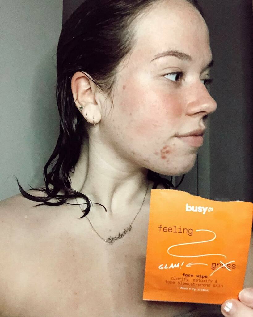 Can't decide which wipes you want? Here's some key facts on the Refresh Face Wipes...
1. They work hard to target and tone blemish prone skin
2. They help to remove excess oil from the skin to help prevent the start of more acne
3. They leave you with th… instagr.am/p/CI0x33WFoKG/