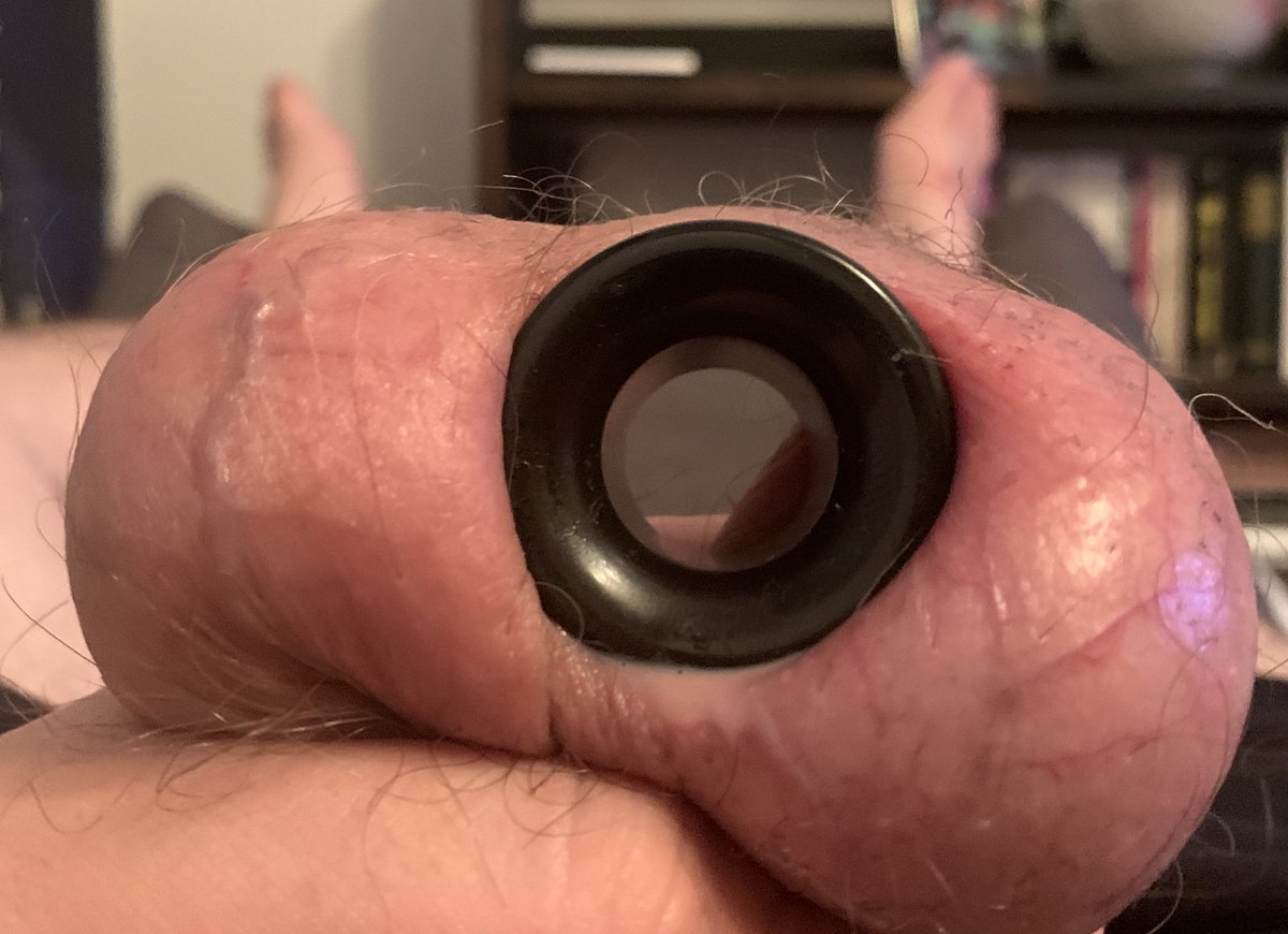 New 28mm transscrotal tunnel. 