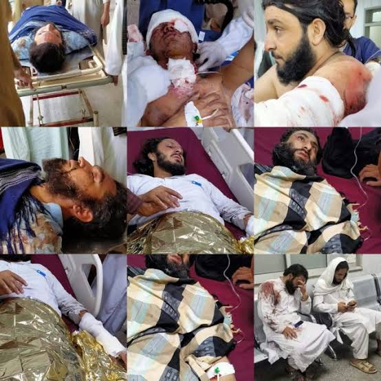 *Ameero ky Bache jin ko koi bi nahi bhula 

*Gareebo maa baap k aalim or hafiz bache jin ko yaad krne se hmari media ko mot ajati ha