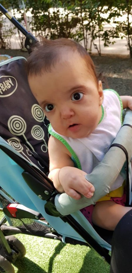 ReecesRainbow's tweet image. We don’t know a lot about sweet Nelly yet, but the agency does have videos of her they can share with inquiring families. She looks like she could have #apertssyndrome or another #craniofacial condition. reecesrainbow.org/131649/nelly #macc2020