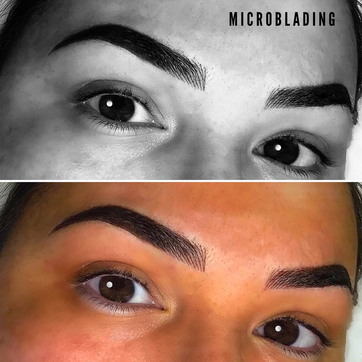 BkHairRemoval's tweet photo. 👑BK 👒BT 💝A&amp;A
#laserhairremoval #hairremoval #bodycontouring #3dmicroblading #beauty #microbladingwithiman #microblading #eyebrowtattoo #microneedling #cellulite #photorejuvenation #skintightening #acnes #hydrafacial #IPL #skinresurfacing #teethwhitening #michigan https://t.co/yHxwPayuJr