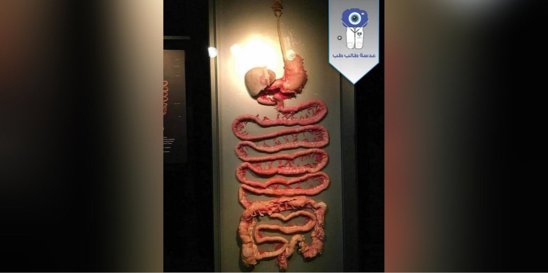 AdasetTalebTb's tweet photo. الجهاز الهضمي لدى الإنسان
#صورة_اليوم
#Digestive_system
#عدسة_طالب_طب https://t.co/vaX9xVRu4H