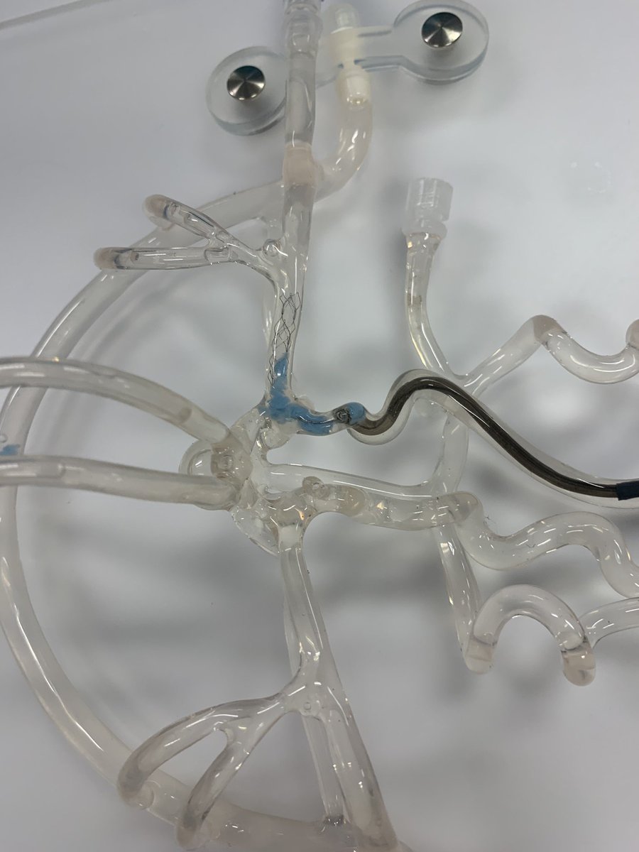 SitaraKoneru's tweet photo. Neuro IR workshop series continues! Thanks @PenNeuro for the chance to practice&amp; learn. S/o to @EmoryNeurology’s own @AlAlBayati1 for teaching us the ropes. Many TICI 3 thrombectomies tonight! @DLandzberg @DrKuybu @BouslamaMd @ChungCharlotte @Oga_DoctorBlue @ShaerQasem @DrBlue_JT https://t.co/5zJ3PKj82m