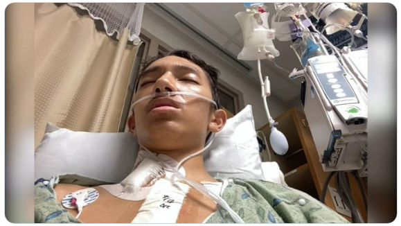 QB William 'Ikaika' Bailey, 19, from Merced, CA contracted  #COVID twice. First time fever & chills. Weeks later his feet swelled & gained 20 lbs from heart failure, requiring mechanical valve surgery. He's on blood thinners for the rest of his life.  https://abc7ny.com/health/ca-teen-fights-for-his-life-after-contracting-covid-19-twice/6375925/
