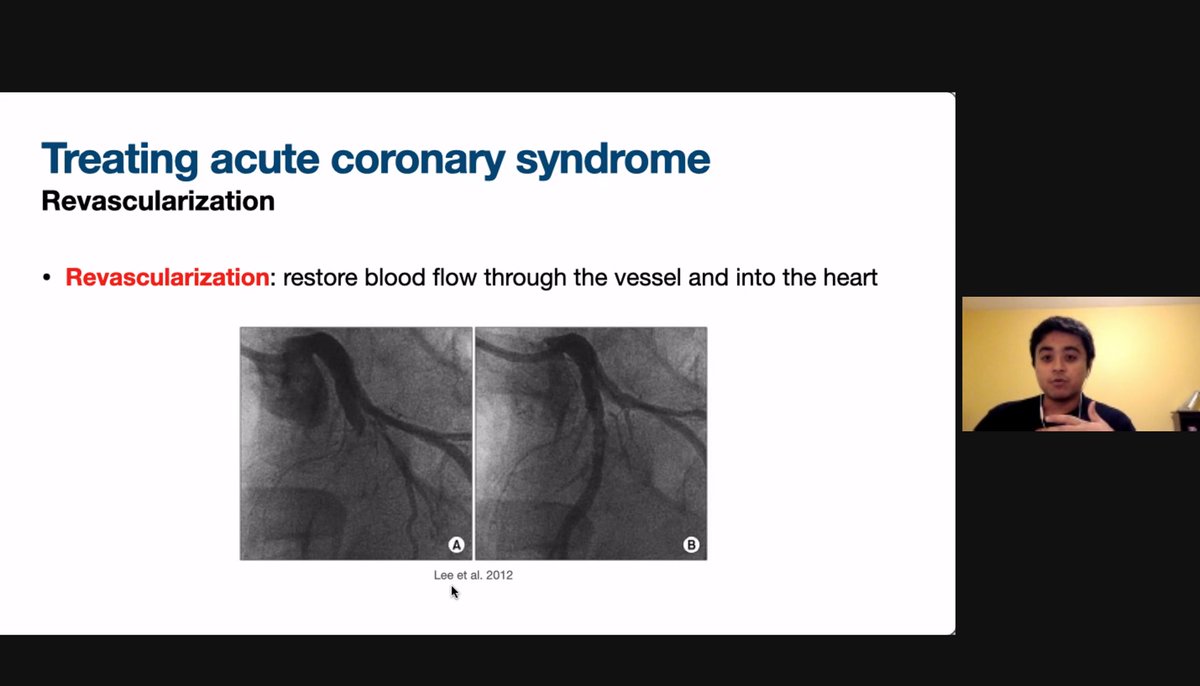 Had a wonderful time teaching ACS to undergraduate students with <a href="/arjunamaharaj/">Arjuna Maharaj</a> as part of the Students as Teachers program <a href="/uoftmedicine/">Temerty Medicine</a>. Like they say, there is no better way to learn than to teach. Thank you <a href="/MyNameIsMena/">Mena g</a> for helping vet our slides!