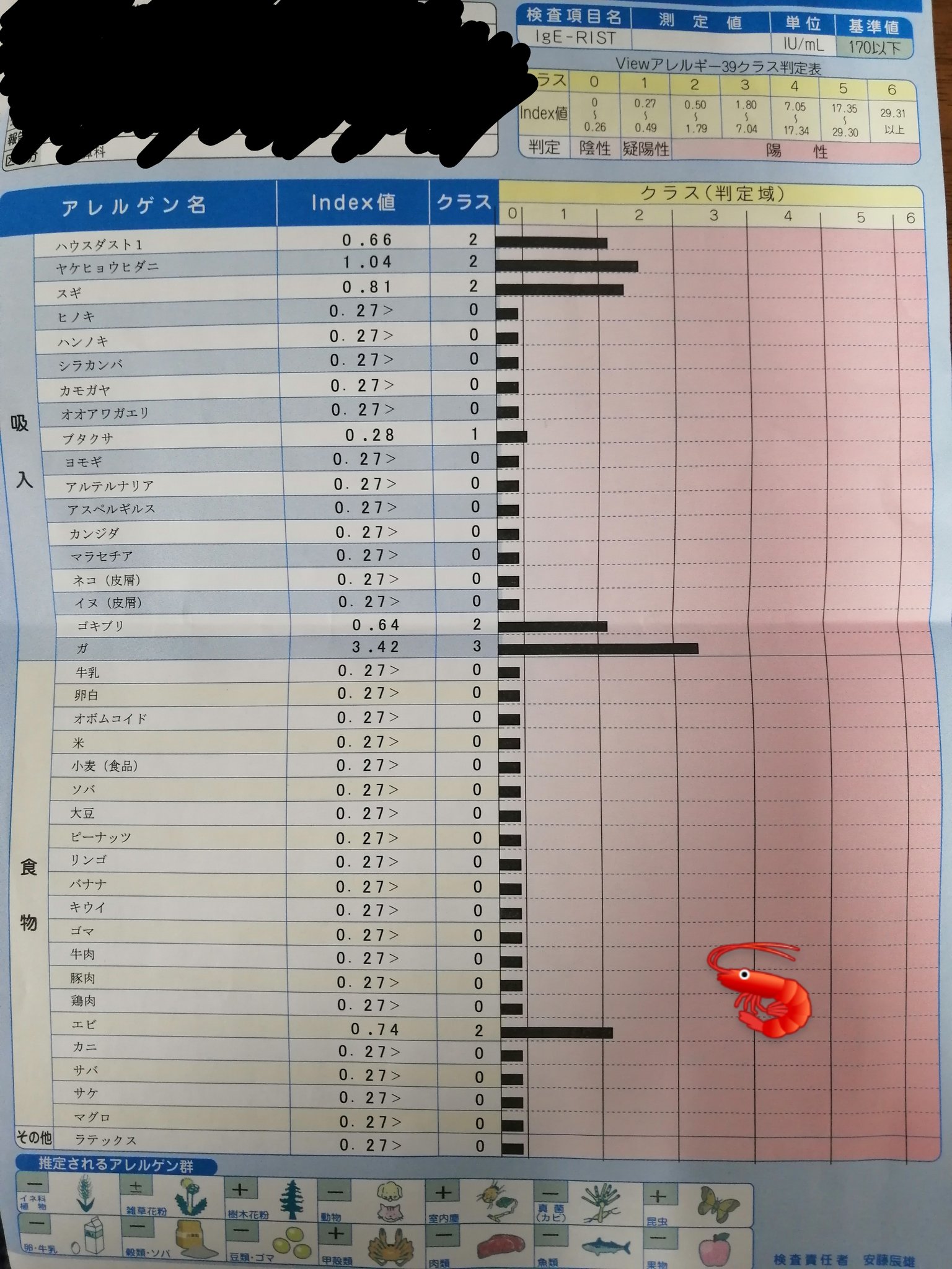 Koiwai Tumsat On Twitter 悲報 エビ研究者の私ですが エビアレルギーであることが本日発覚いたしました Https T Co Xydltdotex Twitter