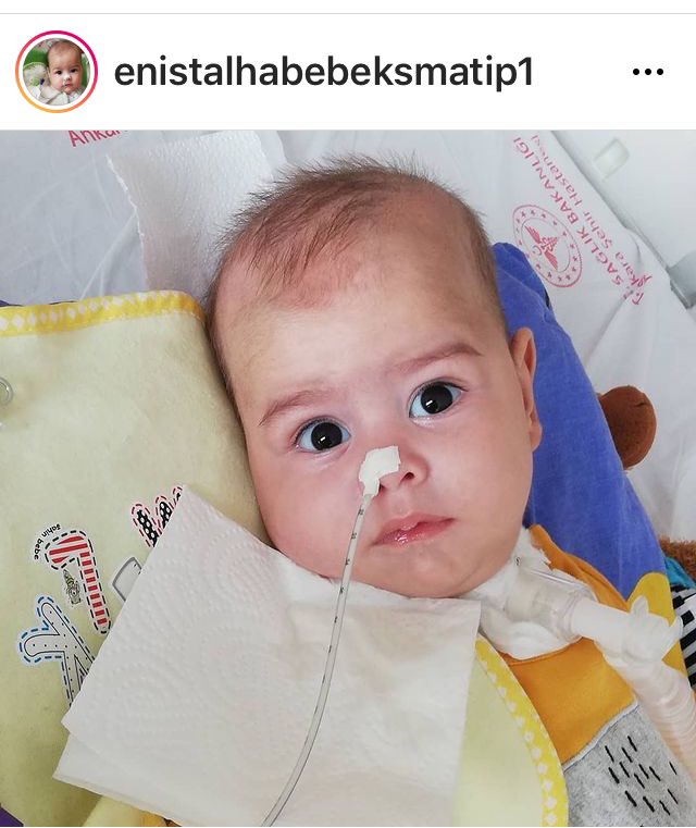 tuncay17yenice1's tweet photo. @mesutyar Günaydın Mesut bey
#DerdimeDerman olun diyor SMA hastası olan minicik bedenler hayata tutunmak nefes almak gülmek için
#EnisiYaşatalım
#ENiSinNefesiOl
@EnisTip1 https://t.co/rJUzvLoBdD