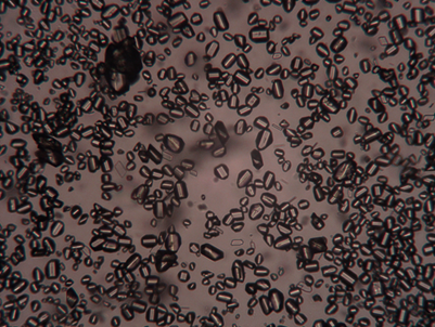 MicroporeTech's tweet photo. Different crystalline shapes of the same API prepared by Micropore to suit customer needs.
#apidevelopment #crystalline #pharmaceutical #pharmadevelopment #membraneemulsification https://t.co/kdmHvw8Fo4