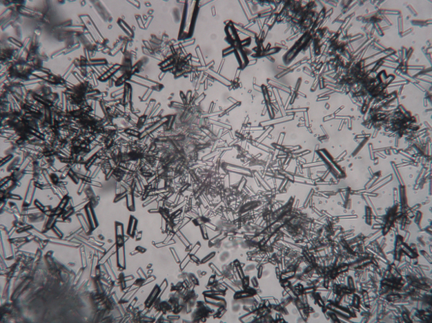 MicroporeTech's tweet photo. Different crystalline shapes of the same API prepared by Micropore to suit customer needs.
#apidevelopment #crystalline #pharmaceutical #pharmadevelopment #membraneemulsification https://t.co/kdmHvw8Fo4