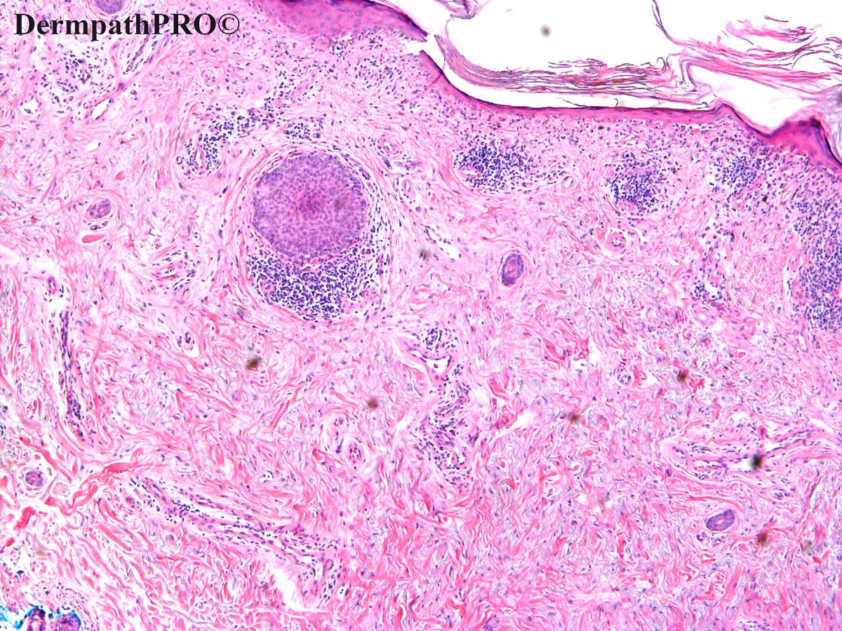 DermpathPRO tweet media