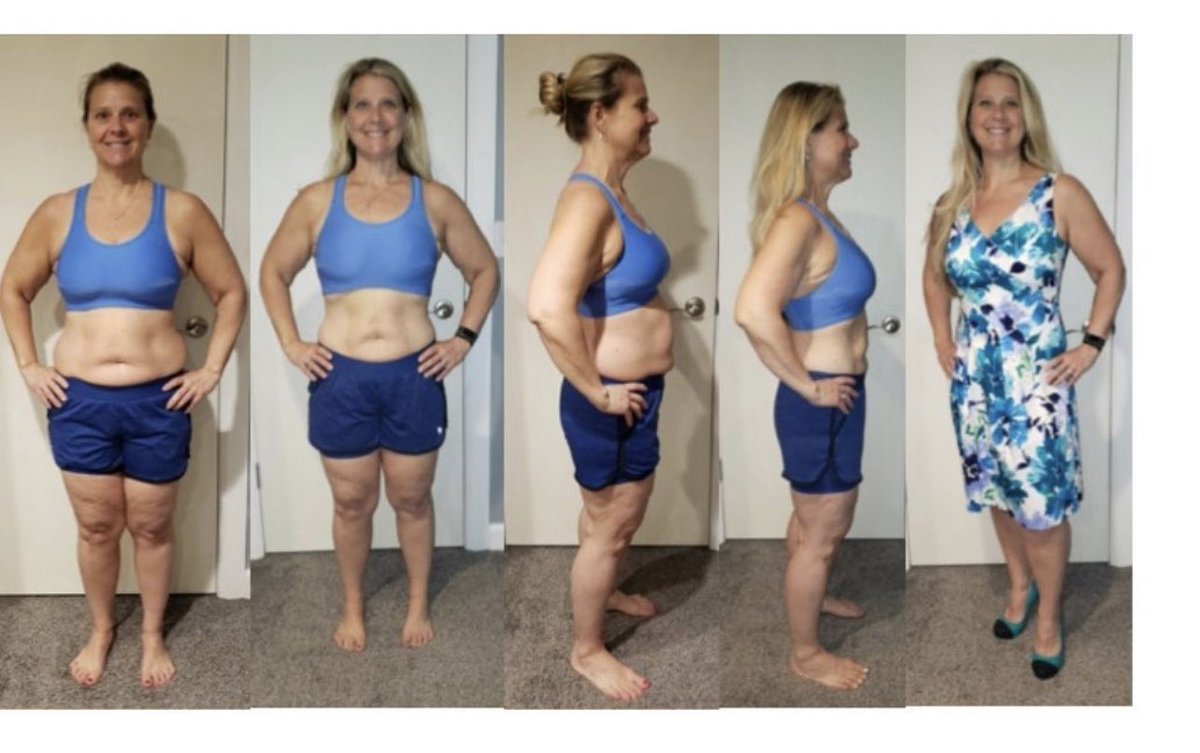 GoCleanse1's tweet photo. Kris was our 2nd place finisher for the GoCleanse Lex and Terry 30 day challenge.
We had some amazing health transformations for many❗️ Real people real results.
https://t.co/k7AhiLPgfz🍏
☎️1-866-352-6888☎️
•
•
•
#nutritionalintermittentfasting #gocleanse #healthyweight https://t.co/cP3cY8IHB4