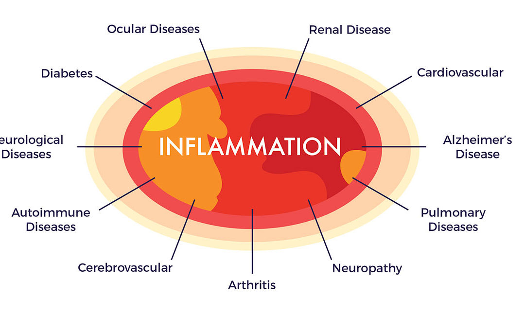 What do     allergies    diabetes    cardiovascular disease &    arthritishave in common?Chronic inflammation:Sounds sexy, right?  No, it doesn't. So let's get rid of it.Chronic inflammation: 1 /6