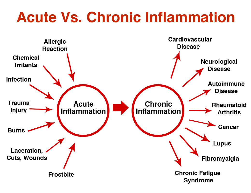 Inflammation is the body's response to poison, toxins, or trauma.ACUTE Inflammation is good when you cut yourself or turn an ankle& plasma proteins, white blood cells, & plateletsTravel to the site of injuryto heal & prevent infection.2/6