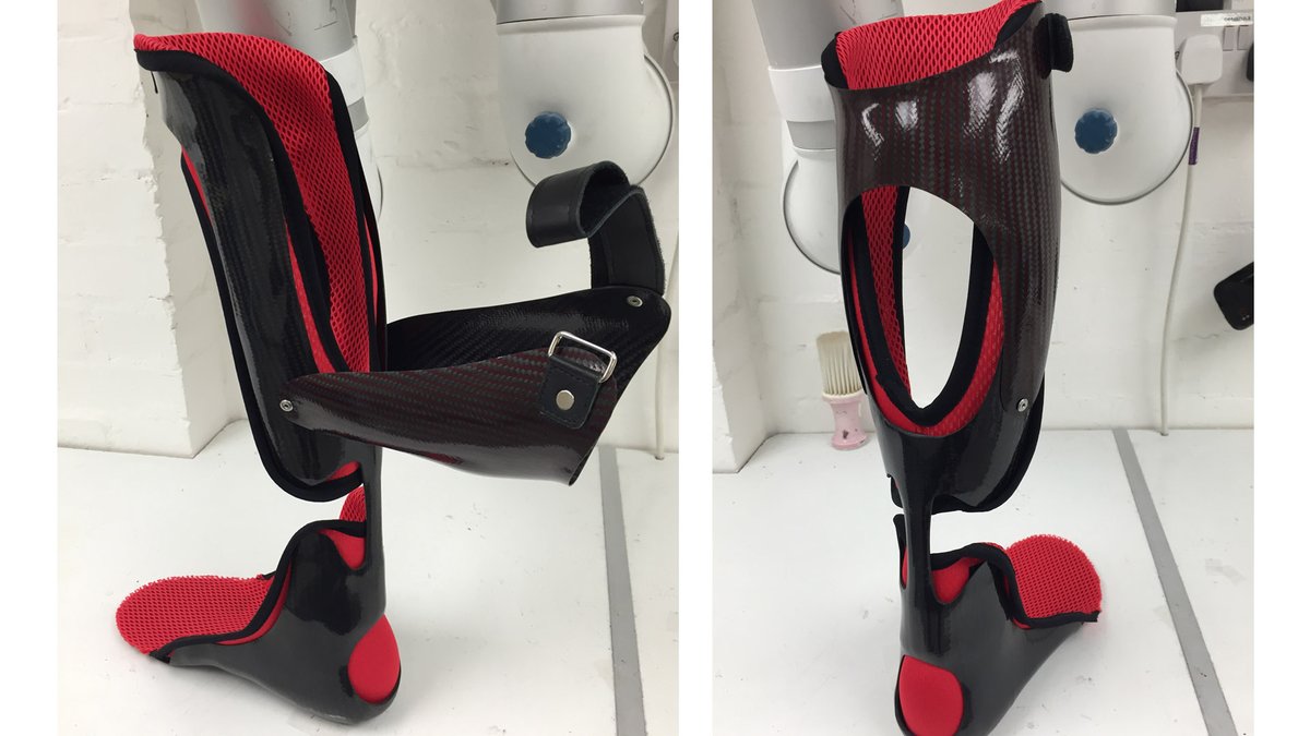 ottobockuk's tweet photo. Our talented Custom Fabrication technicians have a wide range of skill set and are on hand to discuss your design ideas. For more information please contact clinic@ottobock.com.
#FabService #Orthotics #Prosthetics #CustomMade #Fabrication https://t.co/N7bLSxrnld https://t.co/3WU5B1Ff4a