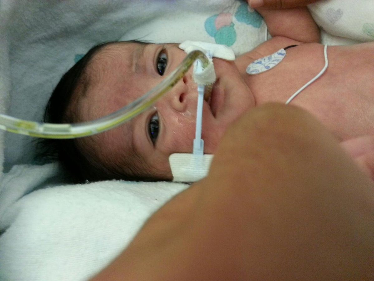 ArtsWithAloha's tweet photo. Born with a rare birth defect of the abdominal wall, Kaiya has had more major operations than the sum of her current age. She is using her unique talents to raise awareness and funds for Ronald McDonald House Charities. #Hawaii #GivingBack (4/4) https://t.co/MKKTyn5Vbh