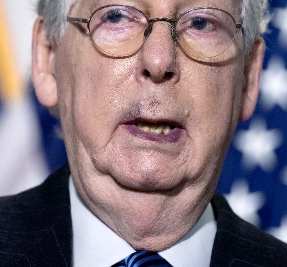 Did someone beat the hell out of TRAITOR  #MitchMcConnell right before the  #Elections? on OCT23, just 10 days before the  #Election, Mitch was sporting some punches to the face looking bruises & hand torture Gangster intimidation style. Then 5 Supreme court justices threatened.