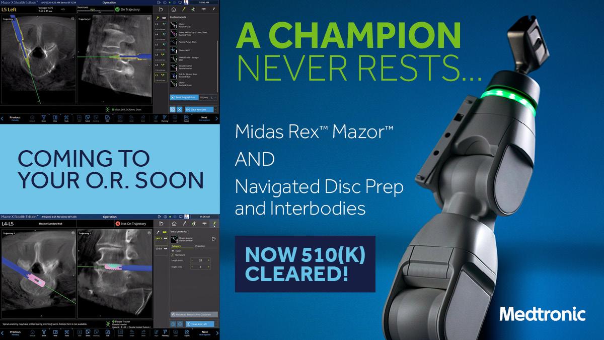 Mazor Robotic Guidance navigated interbody and disc prep and Midas Rex Mazor now FDA cleared.