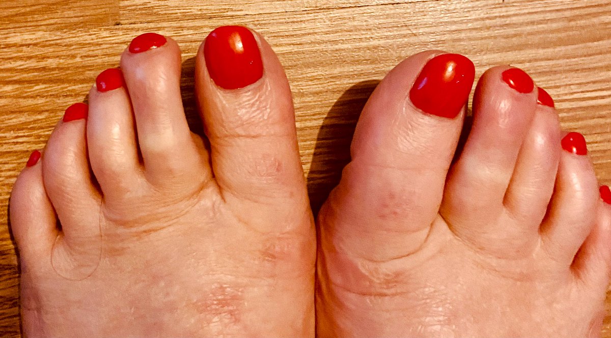 Fabiamariacerra's tweet photo. Had a lovely #gelpolish #pedicure today 🦶💅🏻🔴 #redtoepolish #selfcare https://t.co/GRqoyDoW5y
