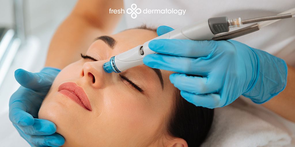 Give yourself the gift of glowing skin with no downtime! HydraFacial uses patented technology to cleanse, extract, and hydrate skin . Perfect for the holiday season. 🌟 Call to speak to our staff with any questions or to schedule your appointment today!  (512) 615-5600 🌟