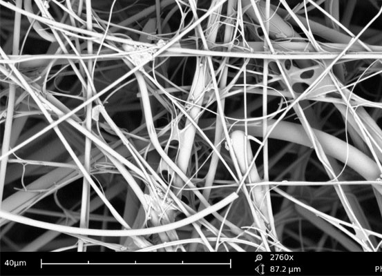 14. PLASTICPlastic might be the most useful and pervasive material in our lives. But what a mess it is to understand at the micro-level: some tangled matt of polymers, with no easily-understandable structure or emergent properties.